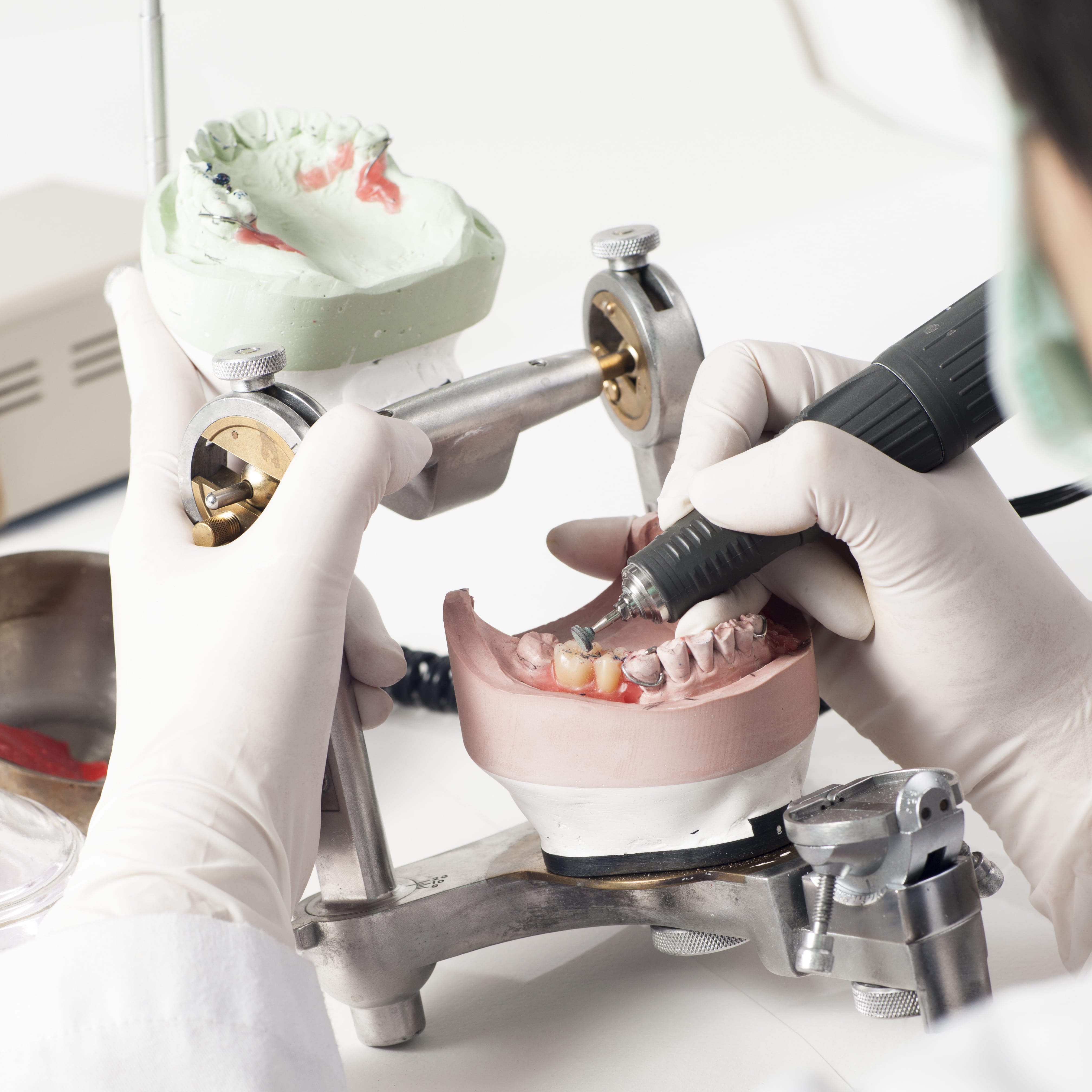 Техника протезиста. Ортопедическая стоматология. Зубные техники. Зубной техник.